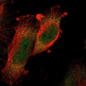 Anti-MAPKAPK5 antibody produced in rabbit 