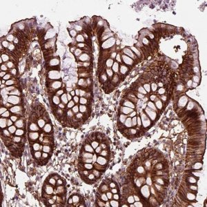 Anti-MARCKS antibody produced in rabbit 