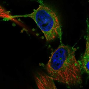 Anti-MARCKS antibody produced in rabbit 