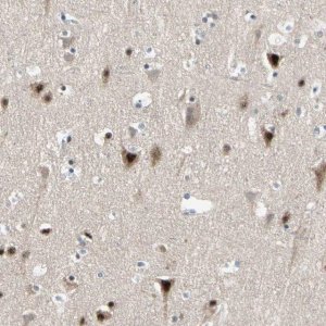 Anti-MARK1 antibody produced in rabbit 
