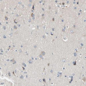 Anti-MARK1 antibody produced in rabbit 