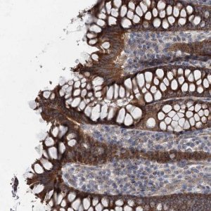 Anti-MARK2 antibody produced in rabbit 