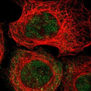 Anti-MAST4 antibody produced in rabbit 