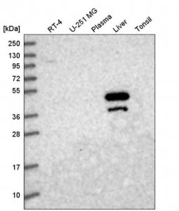 Anti-MAT1A antibody produced in rabbit 