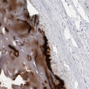 Anti-MATN1 antibody produced in rabbit 