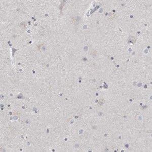 Anti-MATN1 antibody produced in rabbit 