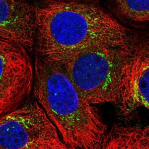 Anti-MATN3 antibody produced in rabbit 