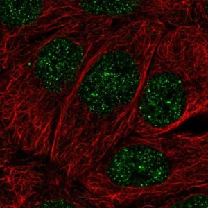 Anti-MBD2 antibody produced in rabbit 
