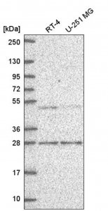 Anti-MBD2 antibody produced in rabbit 