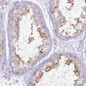 Anti-MBD3L1 antibody produced in rabbit 