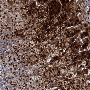 Anti-MBD6 antibody produced in rabbit 