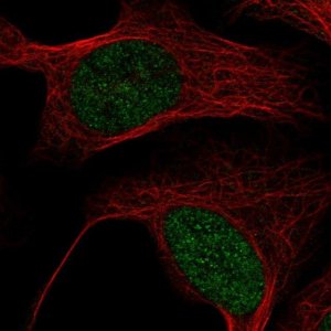 Anti-MBD6 antibody produced in rabbit 