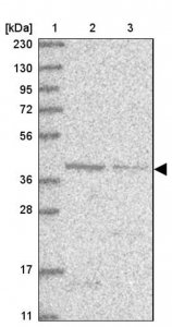 Anti-MCAT antibody produced in rabbit HPA035471-100UL