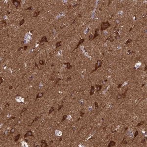 Anti-MCCC1 antibody produced in rabbit 