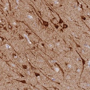 Anti-MCCD1 antibody produced in rabbit 