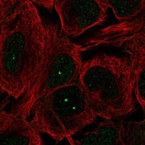 Anti-MCIDAS antibody produced in rabbit 