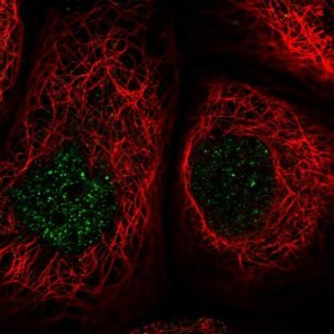 Anti-MCM8 antibody produced in rabbit HPA045141-100UL