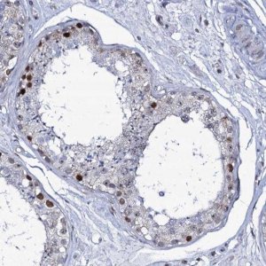 Anti-MCMBP antibody produced in rabbit 