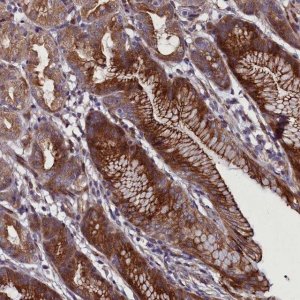 Anti-MCRIP1 antibody produced in rabbit 