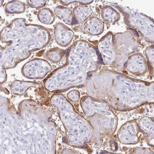 Anti-MDFI antibody produced in rabbit 