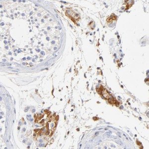 Anti-MDGA2 antibody produced in rabbit 