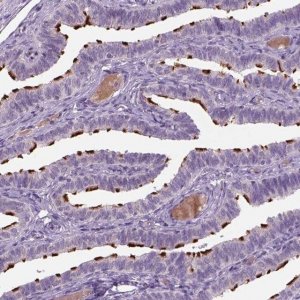Anti-MDH1B antibody produced in rabbit 