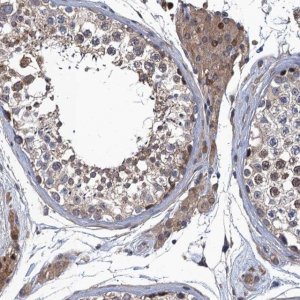 Anti-MDM1 antibody produced in rabbit 