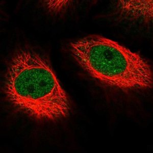 Anti-MED10 antibody produced in rabbit 