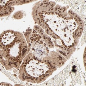 Anti-MED15 antibody produced in rabbit 