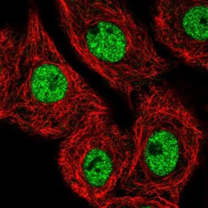Anti-MED25 antibody produced in rabbit 