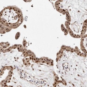 Anti-MED8 antibody produced in rabbit 