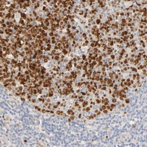 Anti-MEF2B antibody produced in rabbit 