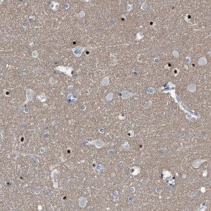 Anti-MEN1 antibody produced in rabbit 