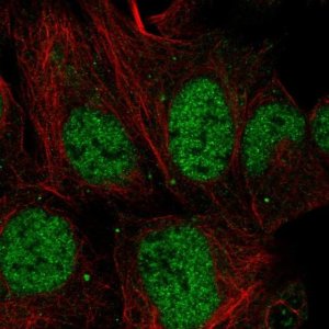 Anti-MESDC1 antibody produced in rabbit 