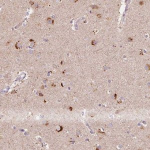 Anti-METTL13 antibody produced in rabbit 