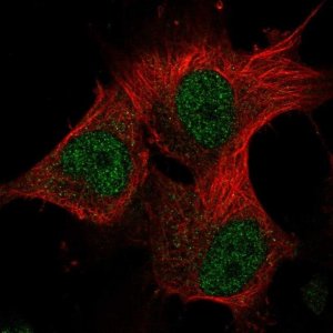 Anti-METTL16 antibody produced in rabbit 