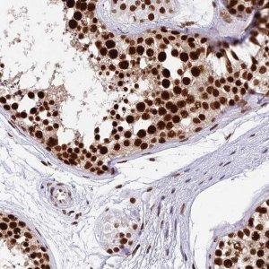 Anti-METTL21B antibody produced in rabbit 