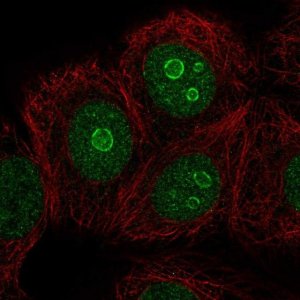 Anti-METTL22 antibody produced in rabbit 