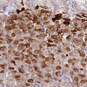 Anti-METTL26 antibody produced in rabbit 