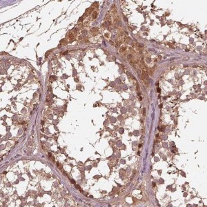 Anti-METTL4 antibody produced in rabbit 