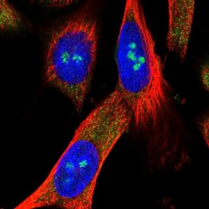 Anti-METTL5 antibody produced in rabbit 