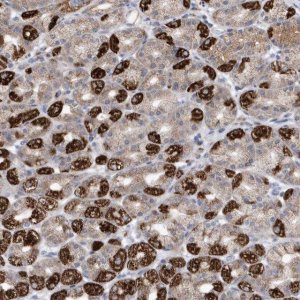 Anti-METTL8 antibody produced in rabbit 