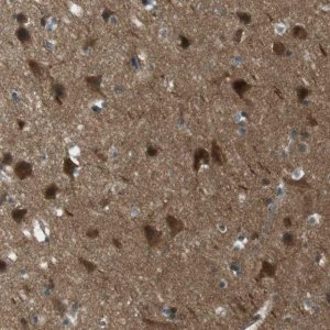 Anti-MFAP3 antibody produced in rabbit HPA015883-100UL