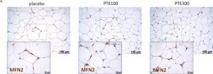 Anti-MFN2 antibody produced in rabbit 