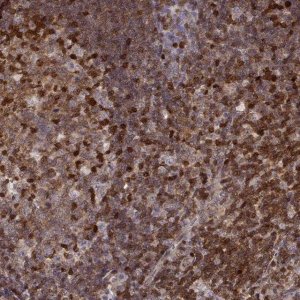 Anti-MFSD1 antibody produced in rabbit 