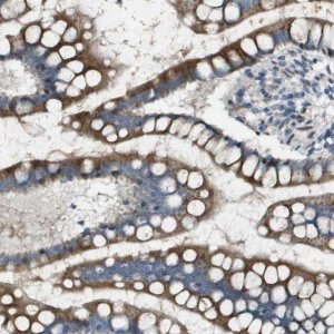 Anti-MGAT3 antibody produced in rabbit 