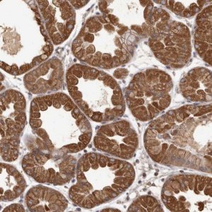 Anti-MGAT5 antibody produced in rabbit 