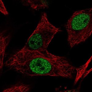 Anti-MGAT5B antibody produced in rabbit 