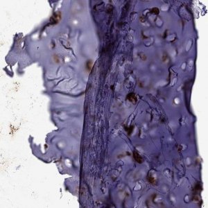 Anti-MGP antibody produced in rabbit 