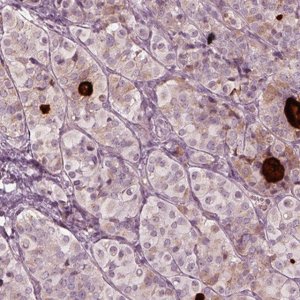 Anti-MIA antibody produced in rabbit 